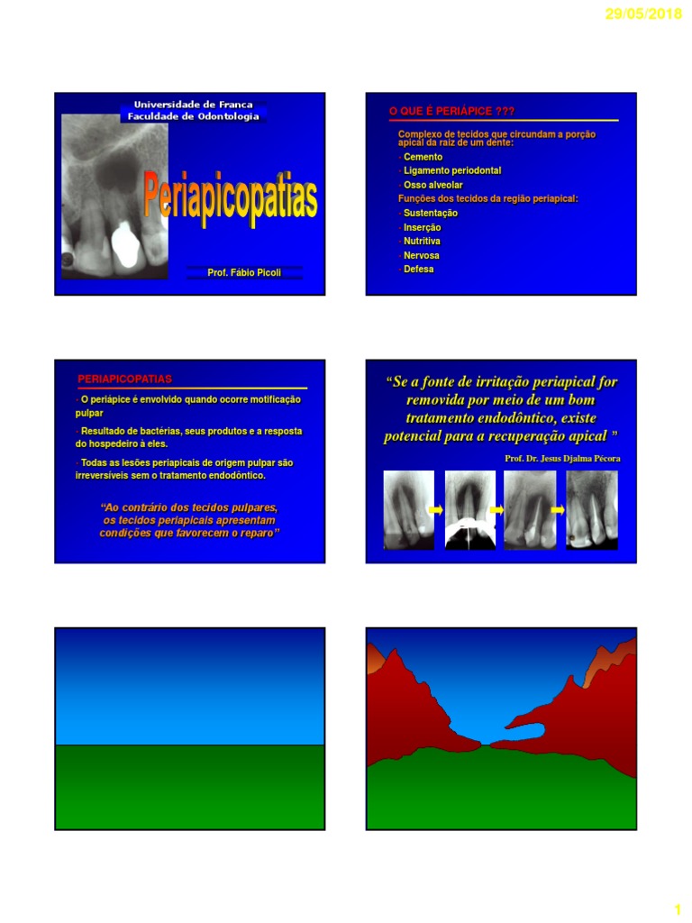Periapicopatias PDF Especialidades médicas Imunologia