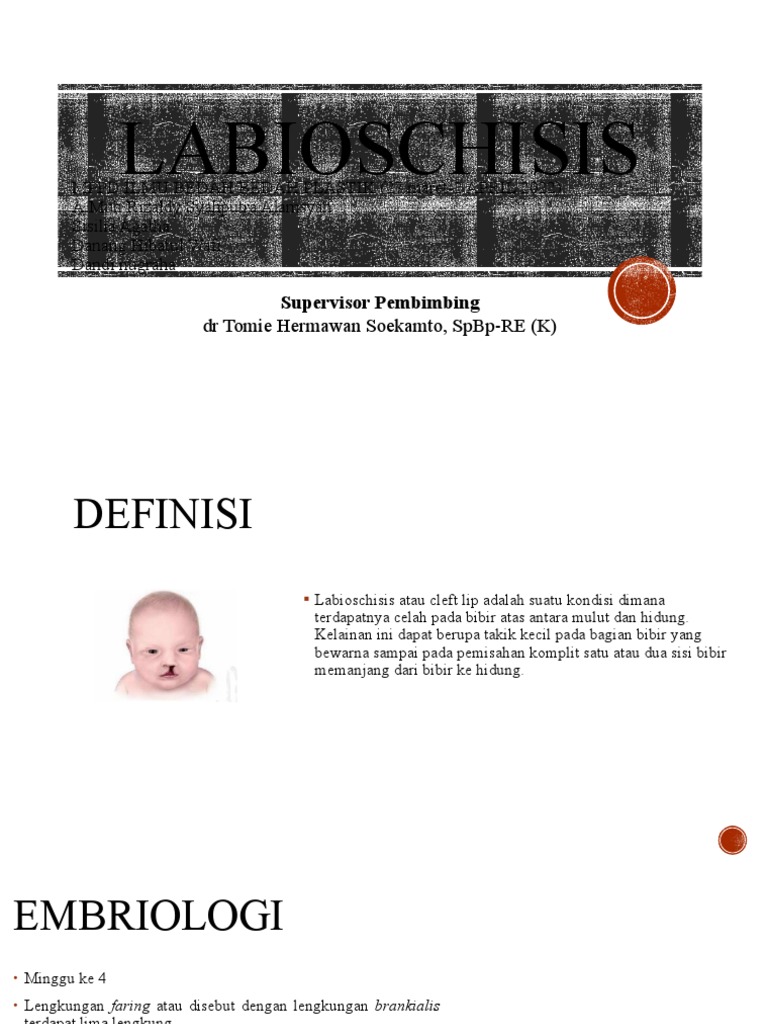 LABIOSCHISIS Presentasi | PDF | Kajian Bahasa Asing | Sains & Matematika
