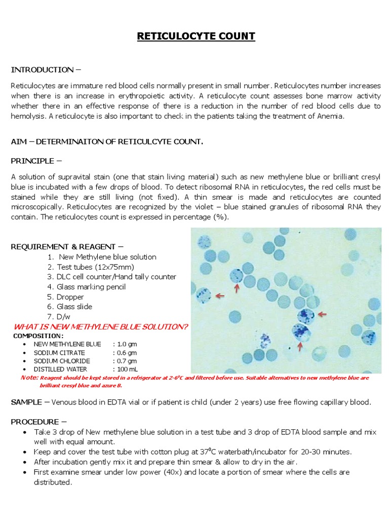 Reticulocyte Count Procedure and Stain | PDF | Anemia | Staining
