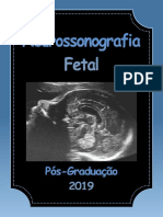 Neurossonografia