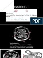 Neurossonografia Primeiro Trimestre