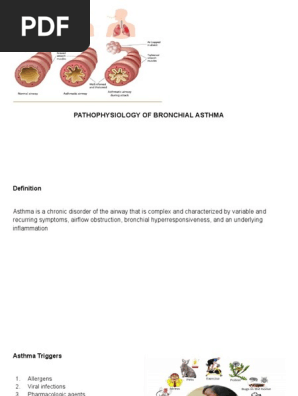 Bronchial Asthma