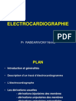 Electrocardiographie: PR Rabearivony Nirina