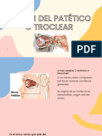 Lesion Del Patetico o Troclear