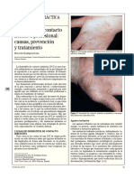 Dermatitis de Contacto Irritativa Profesional: Causas, Prevención y Tratamiento