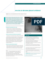 E 5 Derramepleural