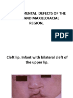 Developmental Defects of the Oral Region