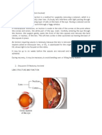 Cataract Extraction