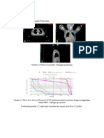 Pasien A A. IMRT 5 Lapangan Penyinaran
