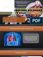 Tromboembolismo Pulmonar y Epoc - Grupo 7