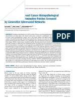 Classifying Breast Cancer Histopathology Images Using Discriminative Patches