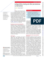 Antiplatelt Before During and Post PCI