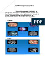 Discapacidad Motora Por Origen Cerebral