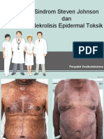 Sindrom Steven Johnson Dan Nekrolisis Epidermal Toksik: Penyakit Vesikulobulosa