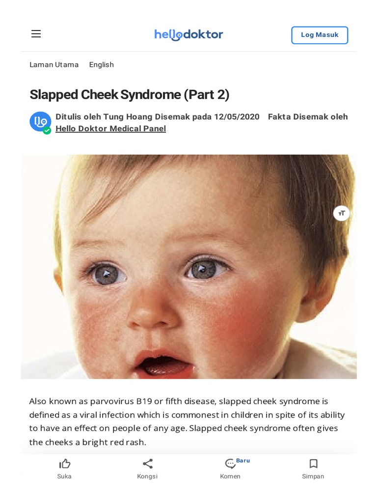 Slapped Cheek Syndrome (Part 2) Hello Doktor PDF Infection