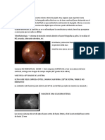 IMAGENOLOGIA OCULAR