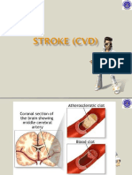 Stroke CVD