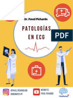 ECG Patologias