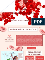 Anemia Megaloblastica