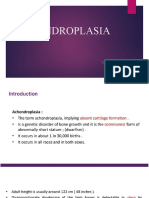 Achondroplasia: DR - Hariprasad Intern