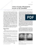 Decompression of Large Odontogenic Keratocysts of The Mandible