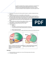 Craniosynostosis