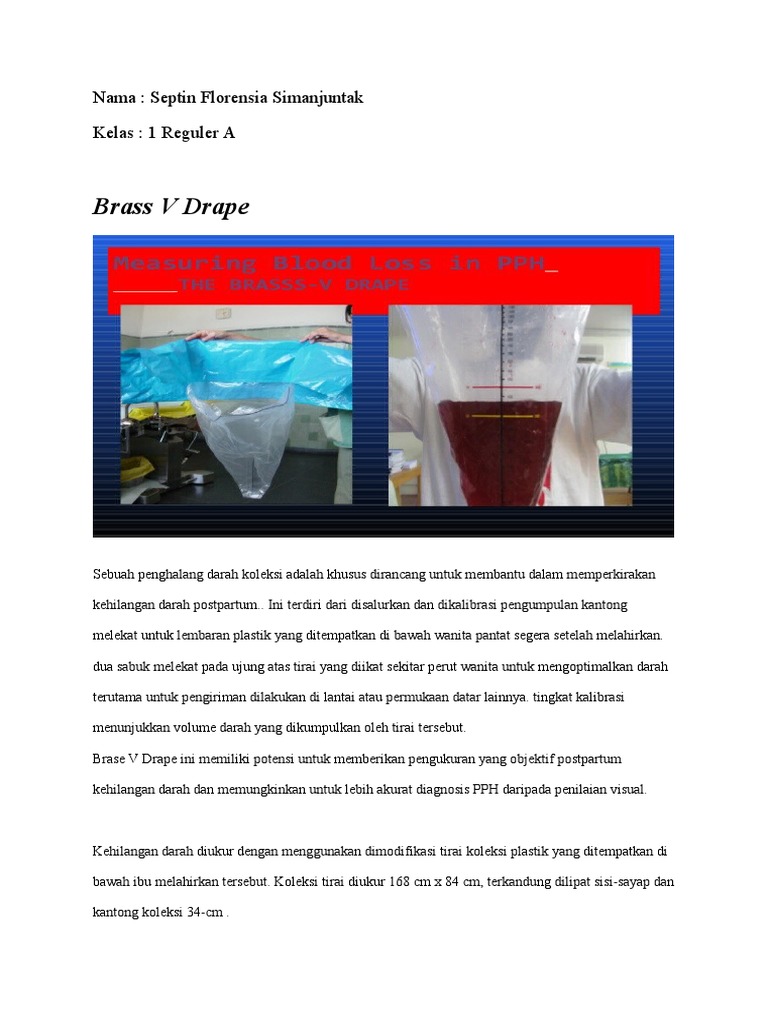 Penggunaan Brass V Drape untuk PPH | PDF