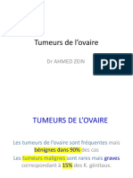 Tumeurs de L'ovaire