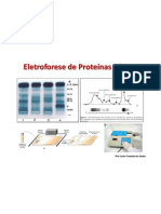 Eletroforese de Proteínas Séricas[1]