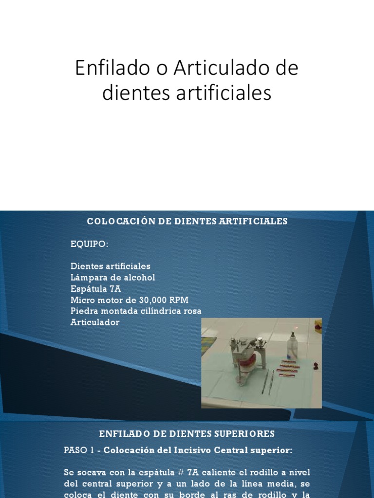 Enfilado o Articulado de Dientes Artificiales | PDF | Odontología ...