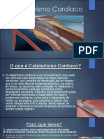 Cateterismo Cardíaco: Diagnóstico e Tratamento de Doenças Cardíacas