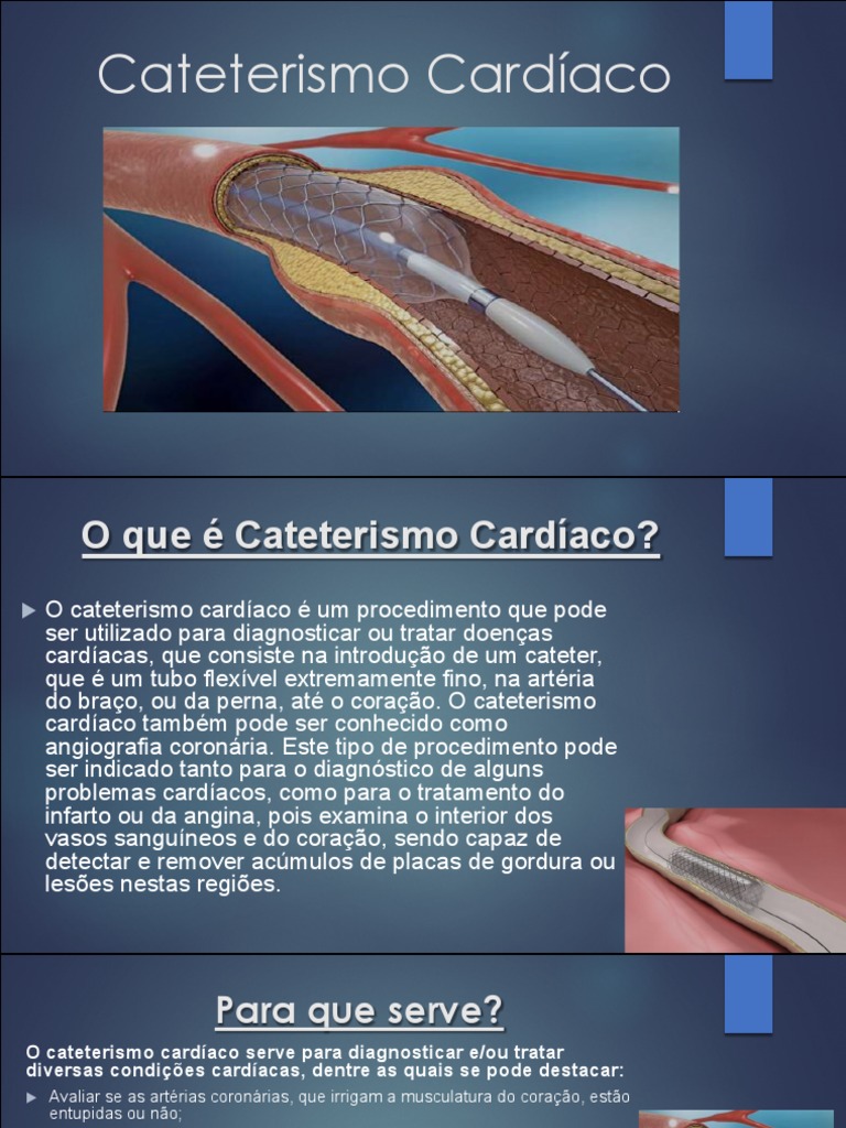 Cateterismo cardíaco: procedimento, finalidade e cuidados | PDF ...