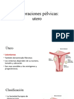 Tumoraciones Pélvicas