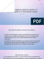 TCE - Hematomas