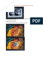 Imágenes de Articulacion Temporomandibular Atm