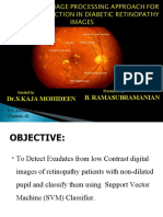 Detecting Diabetic Retinopathy Exudates and Maculopathy using Support Vector Machine