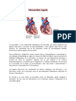 Miocarditis Aguda - Evaluacio N, Manejo y Tratamiento. TBL 1