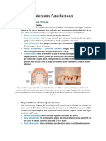 Técnicas anestésicas dentales más comunes