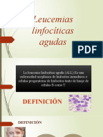 Leucemia Linfoblastica Aguda