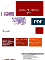 Leucemia Mieloblastica Aguda