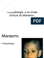 Fisiopatologia e Sinais Do Marasmus