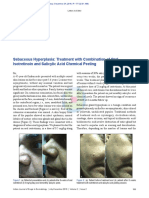 Sebaceous Hyperplasia Treatment With Combination o