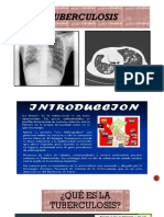 PDF Tuberculosis 2022