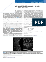 Not All Twitching Is Epileptic! Hand Myoclonus in A Boy With