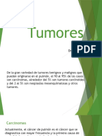 Tumores Pulmonares