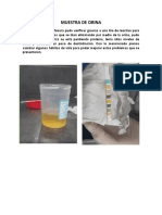 Muestra de Orina Analisis