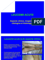 Leucemiile Acute