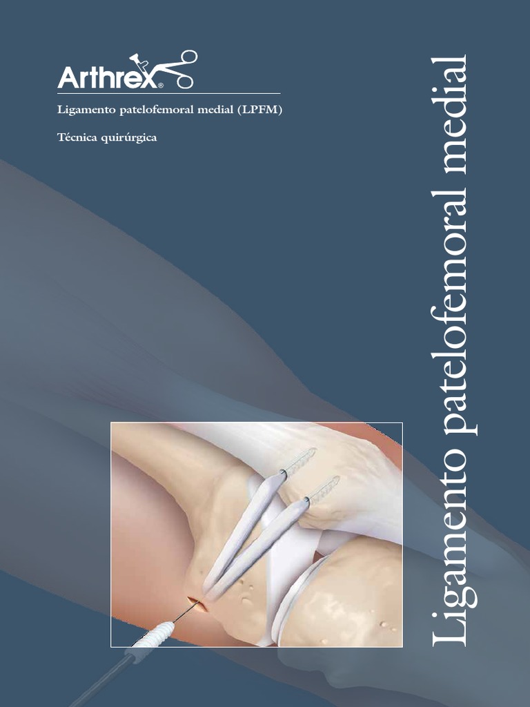 Ligamento Patelofemoral Medial LPFM | PDF | Sistema musculoesquelético ...