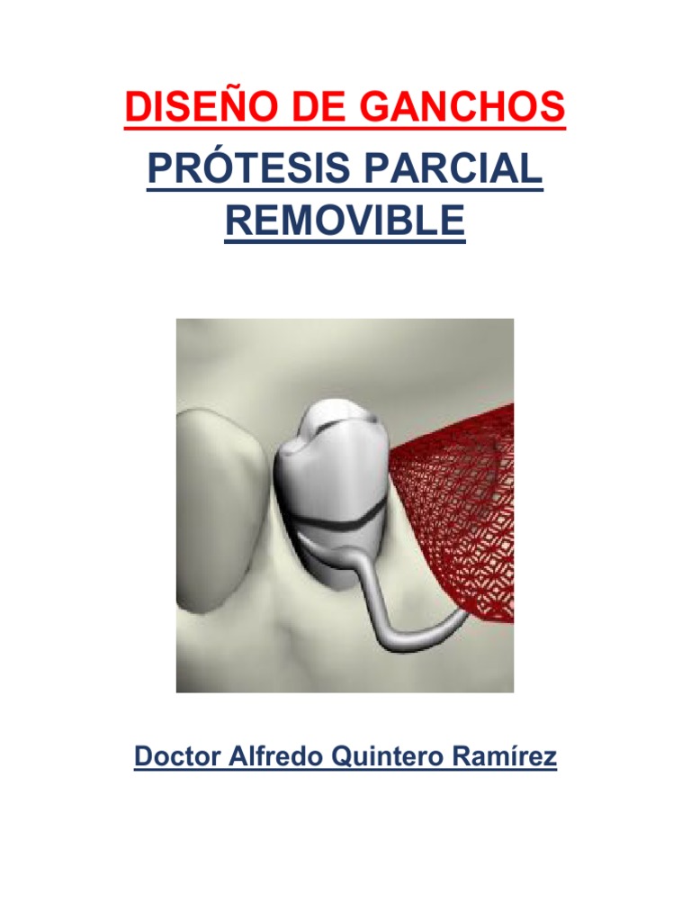 tipos-de-ganchos-en-pr-tesis-removible-pdf-dentadura-postiza-diente