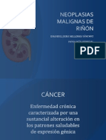 NEOPLASIAS MALIGNAS DE RIÑÓN - Patologia